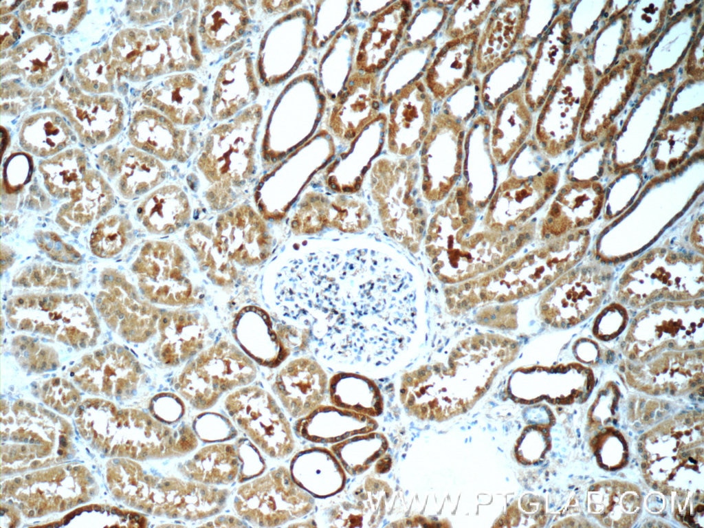 Immunohistochemistry (IHC) staining of human kidney tissue using TSC22D2 Polyclonal antibody (25418-1-AP)