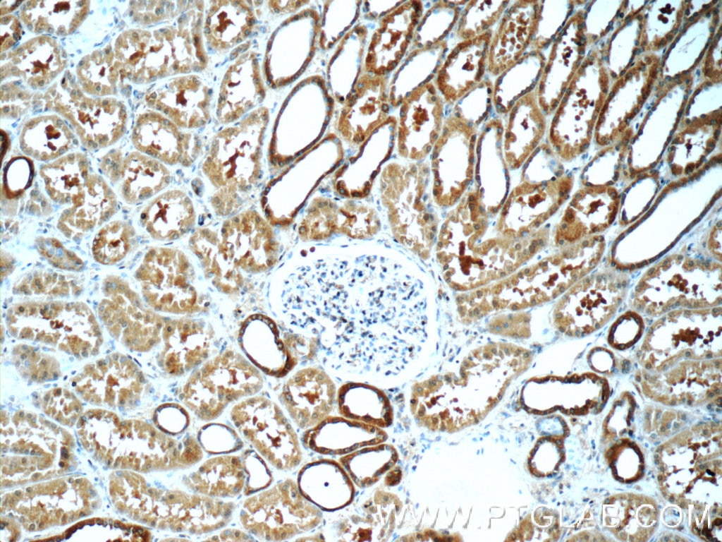 IHC staining of human kidney using 25418-1-AP