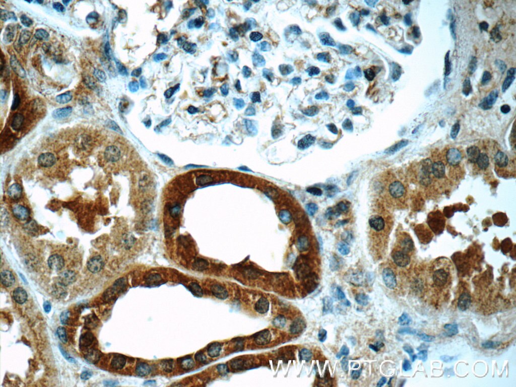 Immunohistochemistry (IHC) staining of human kidney tissue using TSC22D2 Polyclonal antibody (25418-1-AP)