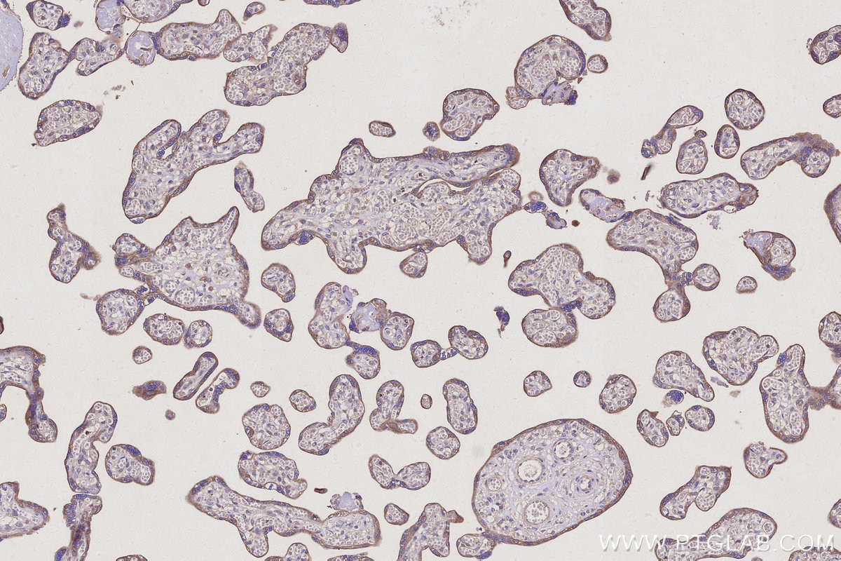 Immunohistochemistry (IHC) staining of human placenta tissue using TSC22D2 Polyclonal antibody (25418-1-AP)