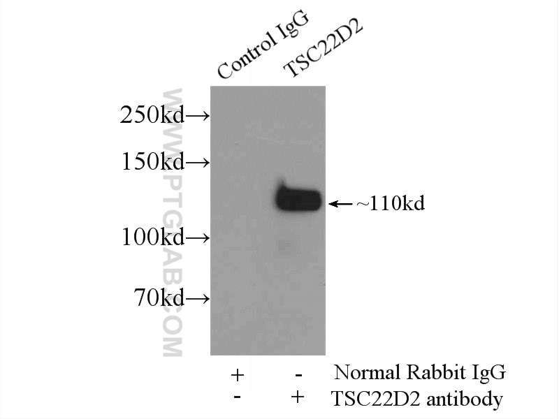 Immunoprecipitation (IP) experiment of HepG2 cells using TSC22D2 Polyclonal antibody (25418-1-AP)