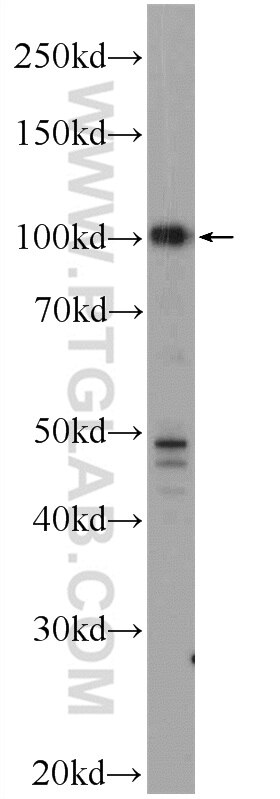 Western Blot (WB) analysis of HepG2 cells using TSC22D2 Polyclonal antibody (25418-1-AP)