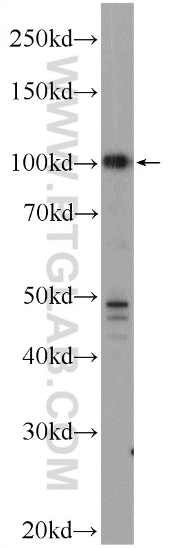 WB analysis of HepG2 using 25418-1-AP