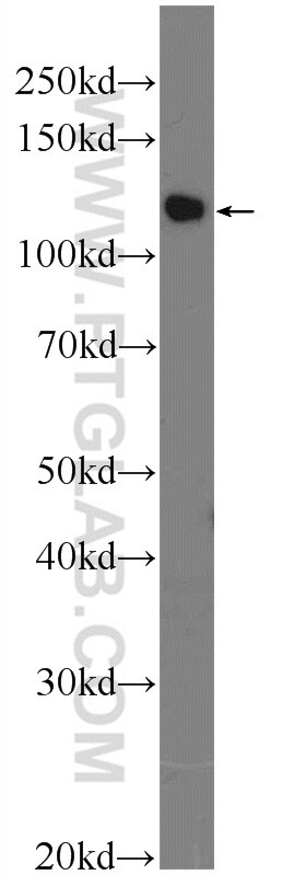 Western Blot (WB) analysis of HeLa cells using TSC22D2 Polyclonal antibody (25418-1-AP)