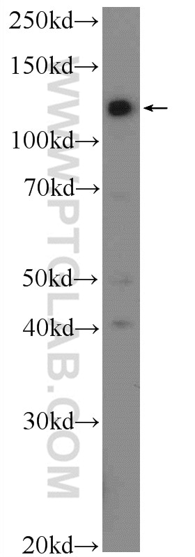 Western Blot (WB) analysis of MDA-MB-453s cells using TSC22D2 Polyclonal antibody (25418-1-AP)