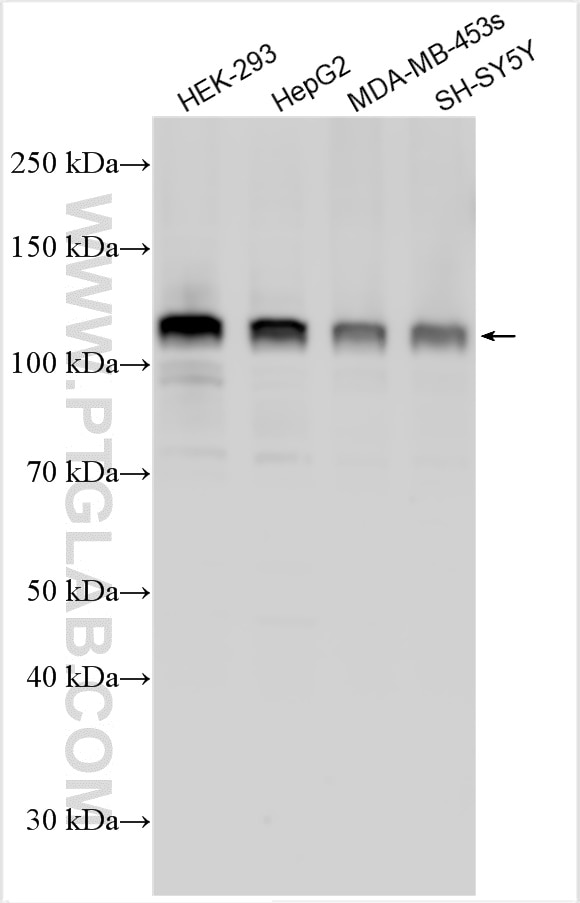 Western Blot (WB) analysis of various lysates using TSC22D2 Polyclonal antibody (25418-1-AP)