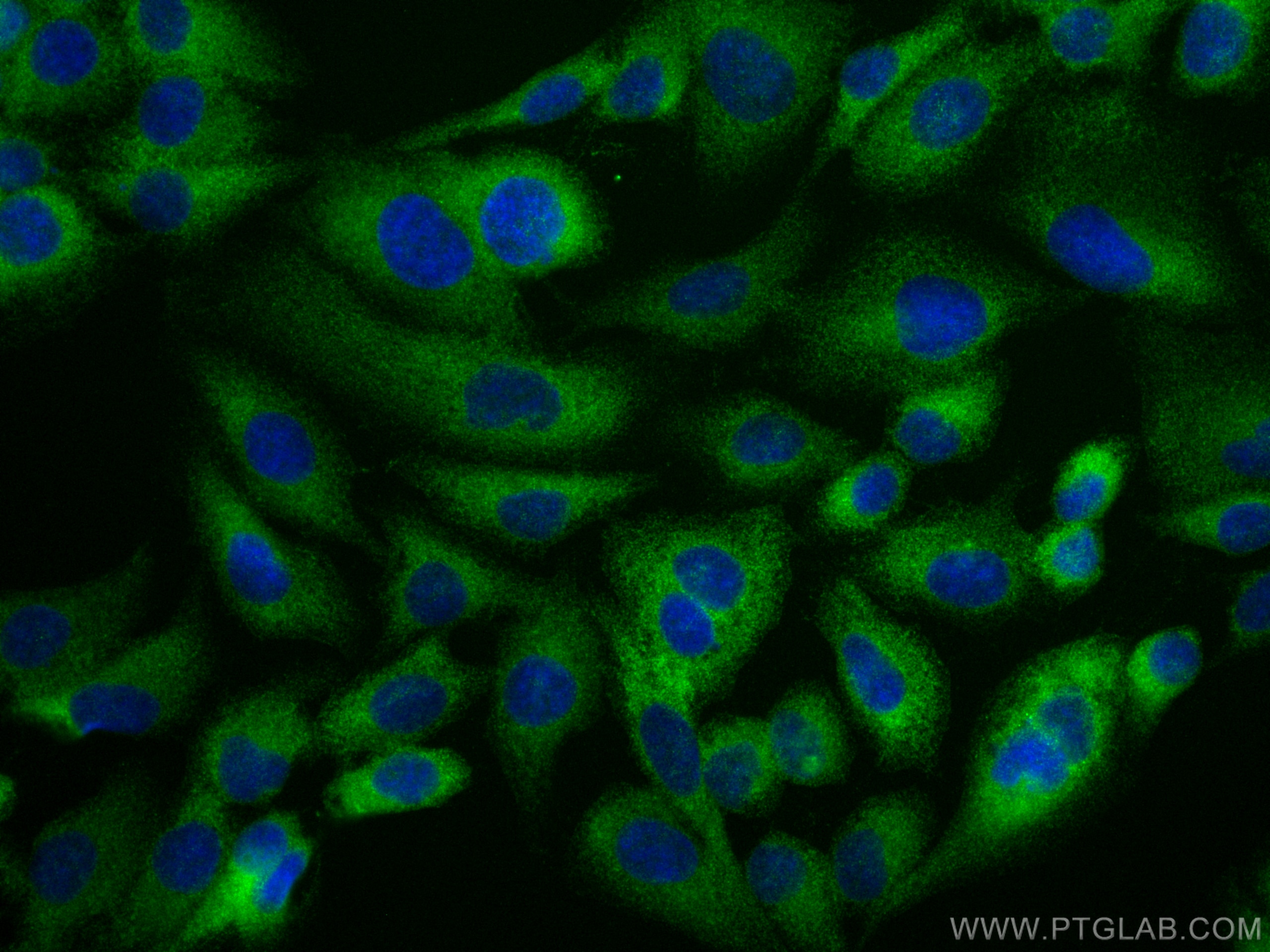 Immunofluorescence (IF) / fluorescent staining of U2OS cells using GILZ Polyclonal antibody (12352-1-AP)