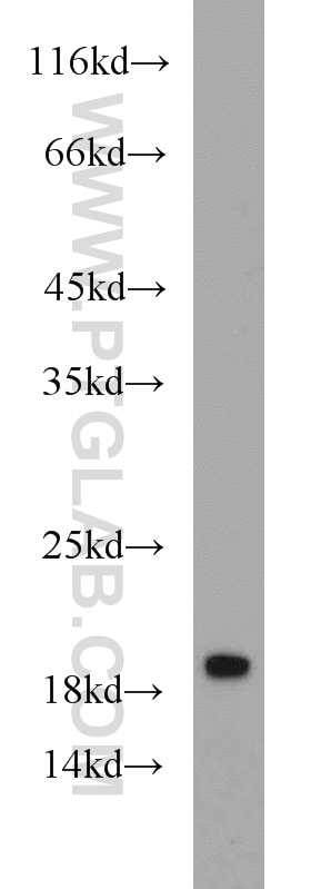 Western Blot (WB) analysis of mouse brain tissue using GILZ Polyclonal antibody (12352-1-AP)