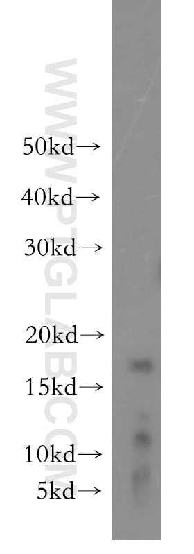 Western Blot (WB) analysis of mouse brain tissue using GILZ Polyclonal antibody (12352-1-AP)