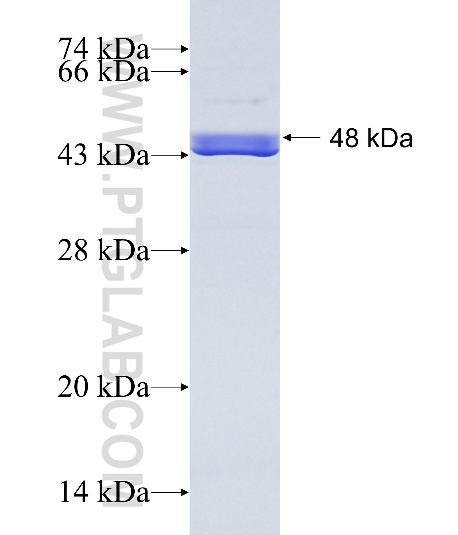TSEN15 fusion protein Ag22156 SDS-PAGE
