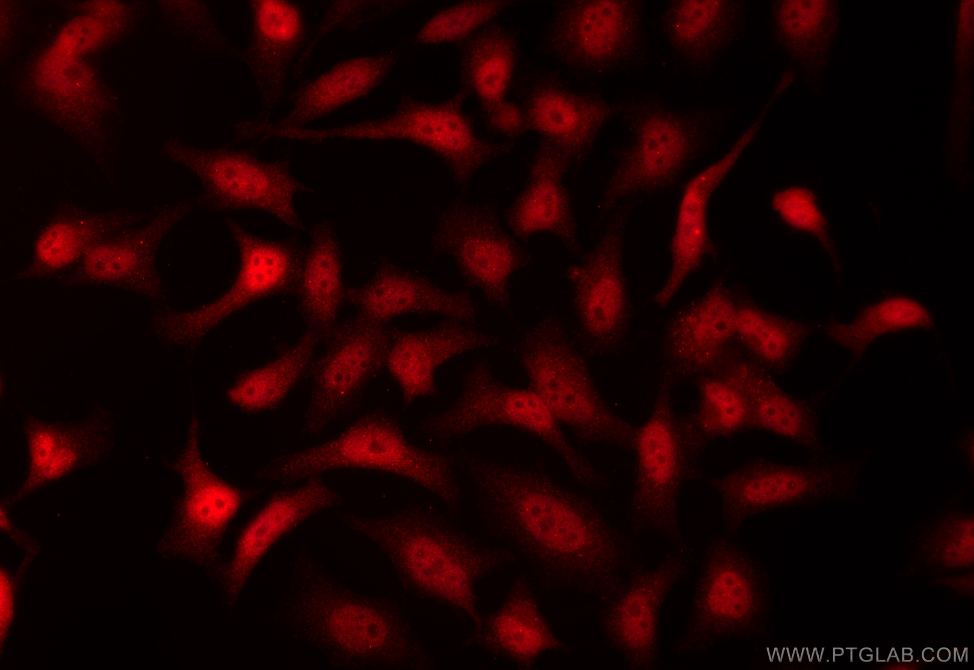 Immunofluorescence (IF) / fluorescent staining of HeLa cells using TSEN2 Polyclonal antibody (13103-2-AP)