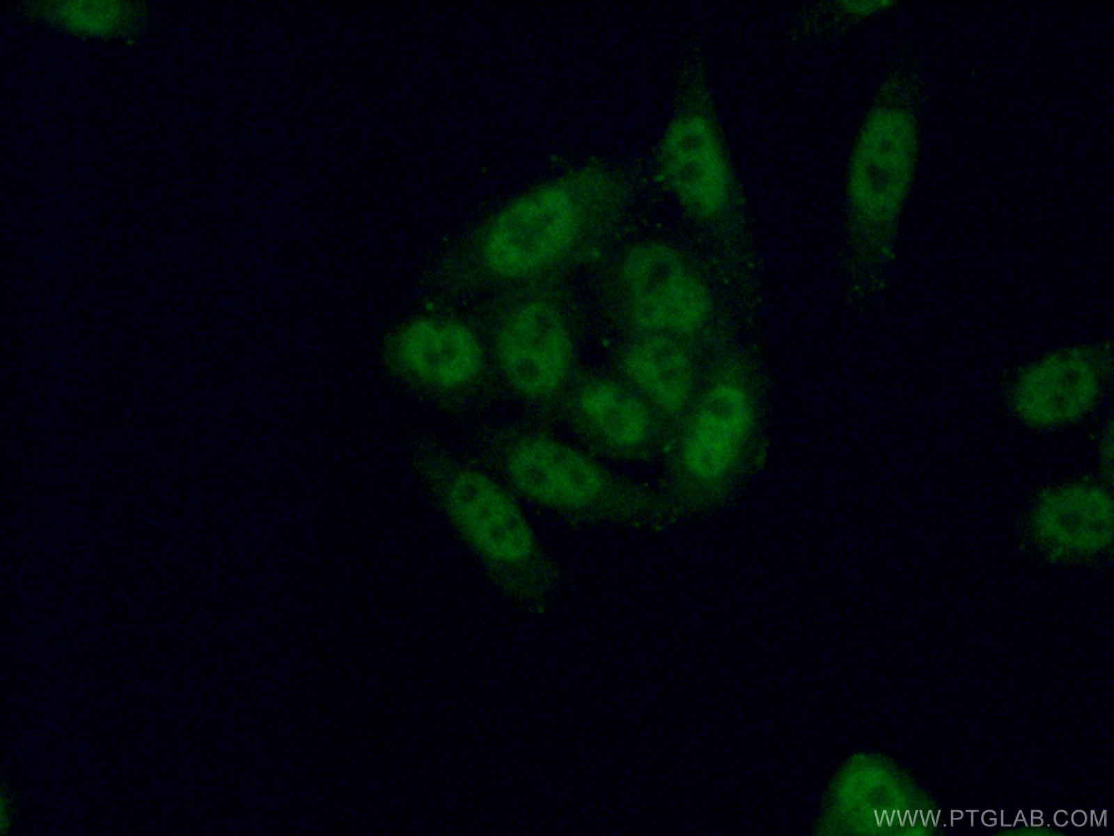 Immunofluorescence (IF) / fluorescent staining of HeLa cells using TSEN2 Polyclonal antibody (13103-2-AP)