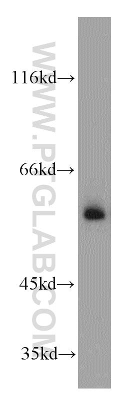 Western Blot (WB) analysis of mouse colon tissue using TSEN2 Polyclonal antibody (13103-2-AP)