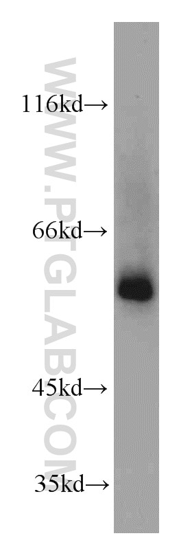 Western Blot (WB) analysis of mouse colon tissue using TSEN2 Polyclonal antibody (13103-2-AP)