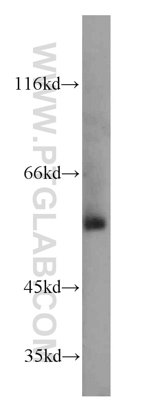 Western Blot (WB) analysis of mouse brain tissue using TSEN2 Polyclonal antibody (13103-2-AP)