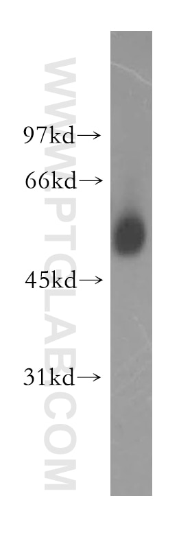 Western Blot (WB) analysis of human brain tissue using TSEN2 Polyclonal antibody (13103-2-AP)