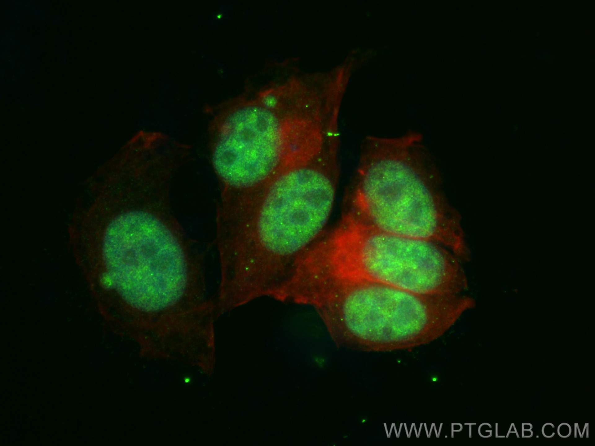 Immunofluorescence (IF) / fluorescent staining of MCF-7 cells using TSEN34 Polyclonal antibody (31212-1-AP)