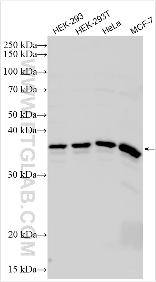 Western Blot (WB) analysis of various lysates using TSEN34 Polyclonal antibody (31212-1-AP)