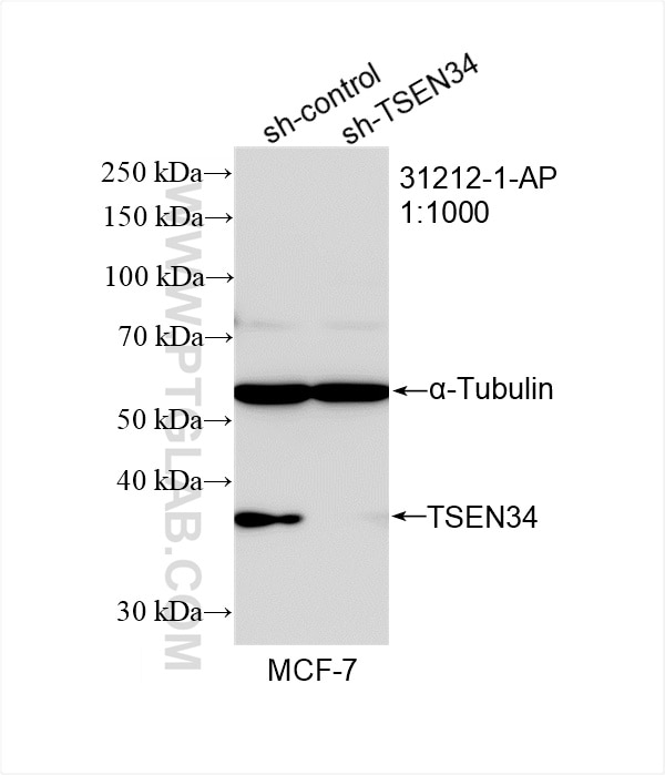 Western Blot (WB) analysis of MCF-7 cells using TSEN34 Polyclonal antibody (31212-1-AP)