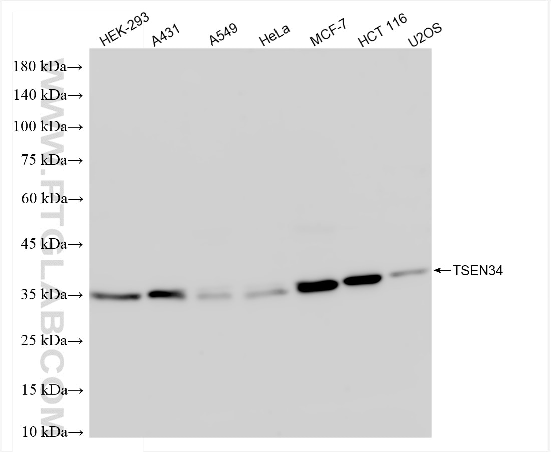 Western Blot (WB) analysis of various lysates using TSEN34 Recombinant antibody (84102-5-RR)