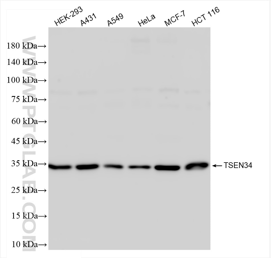 Western Blot (WB) analysis of various lysates using TSEN34 Recombinant antibody (84102-6-RR)