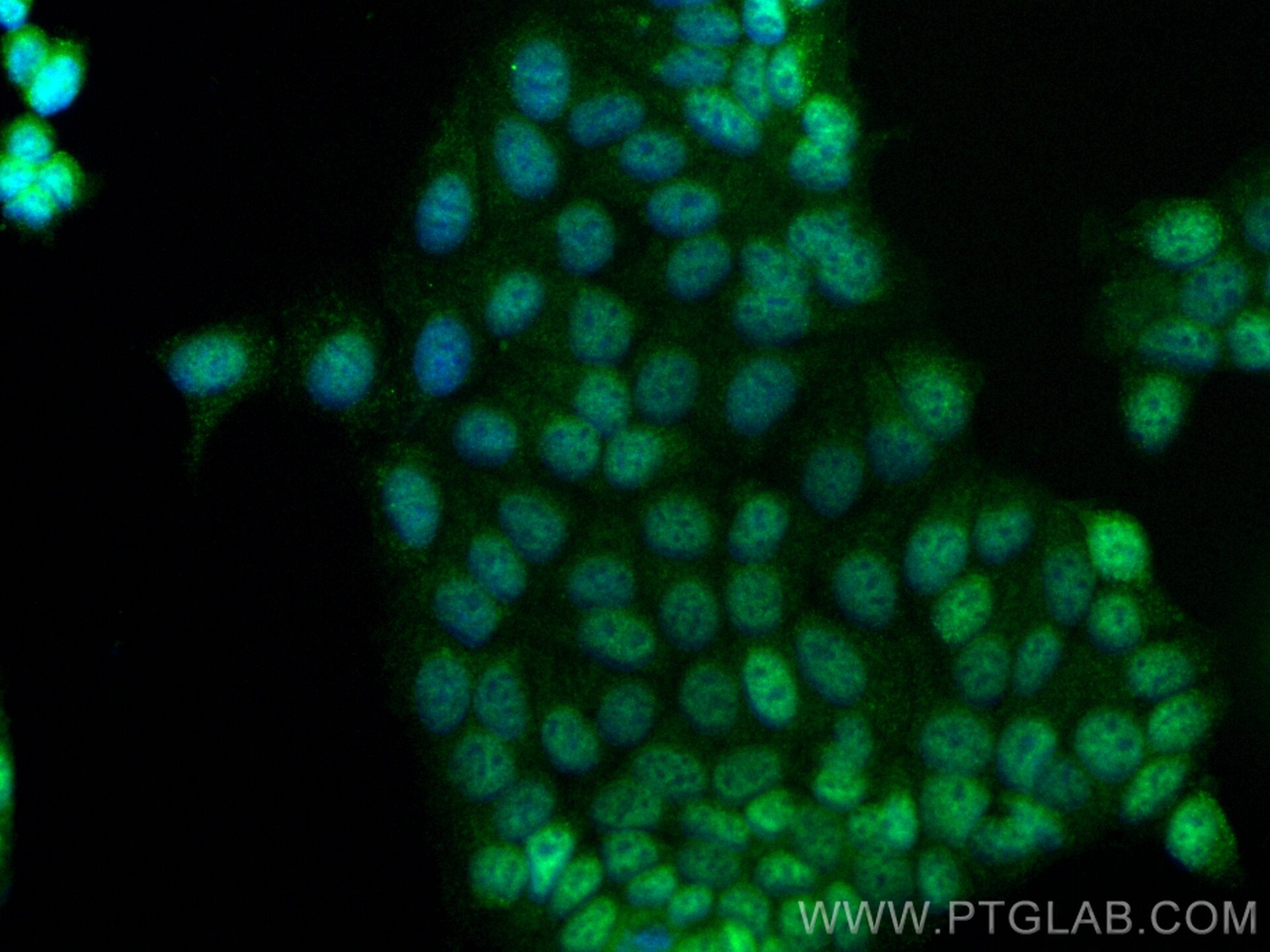 Immunofluorescence (IF) / fluorescent staining of MCF-7 cells using CoraLite® Plus 488-conjugated TSEN34 Recombinant a (CL488-84102-5)