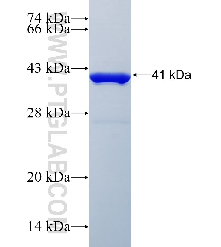 TSEN34 fusion protein Ag35120 SDS-PAGE