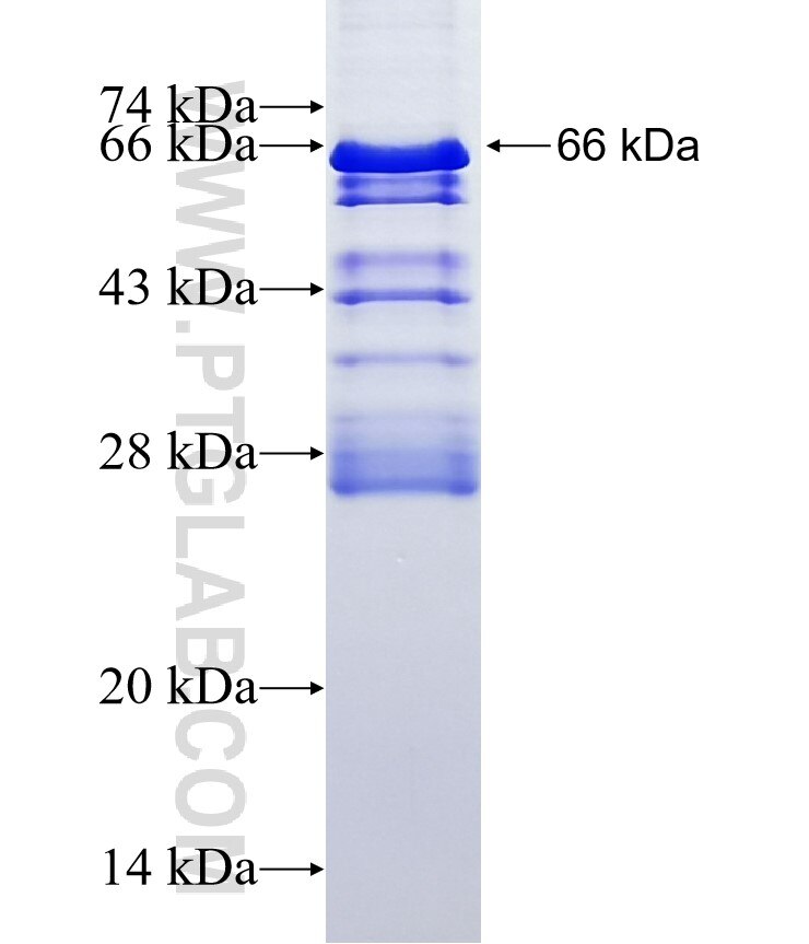 TSEN34 fusion protein Ag10175 SDS-PAGE