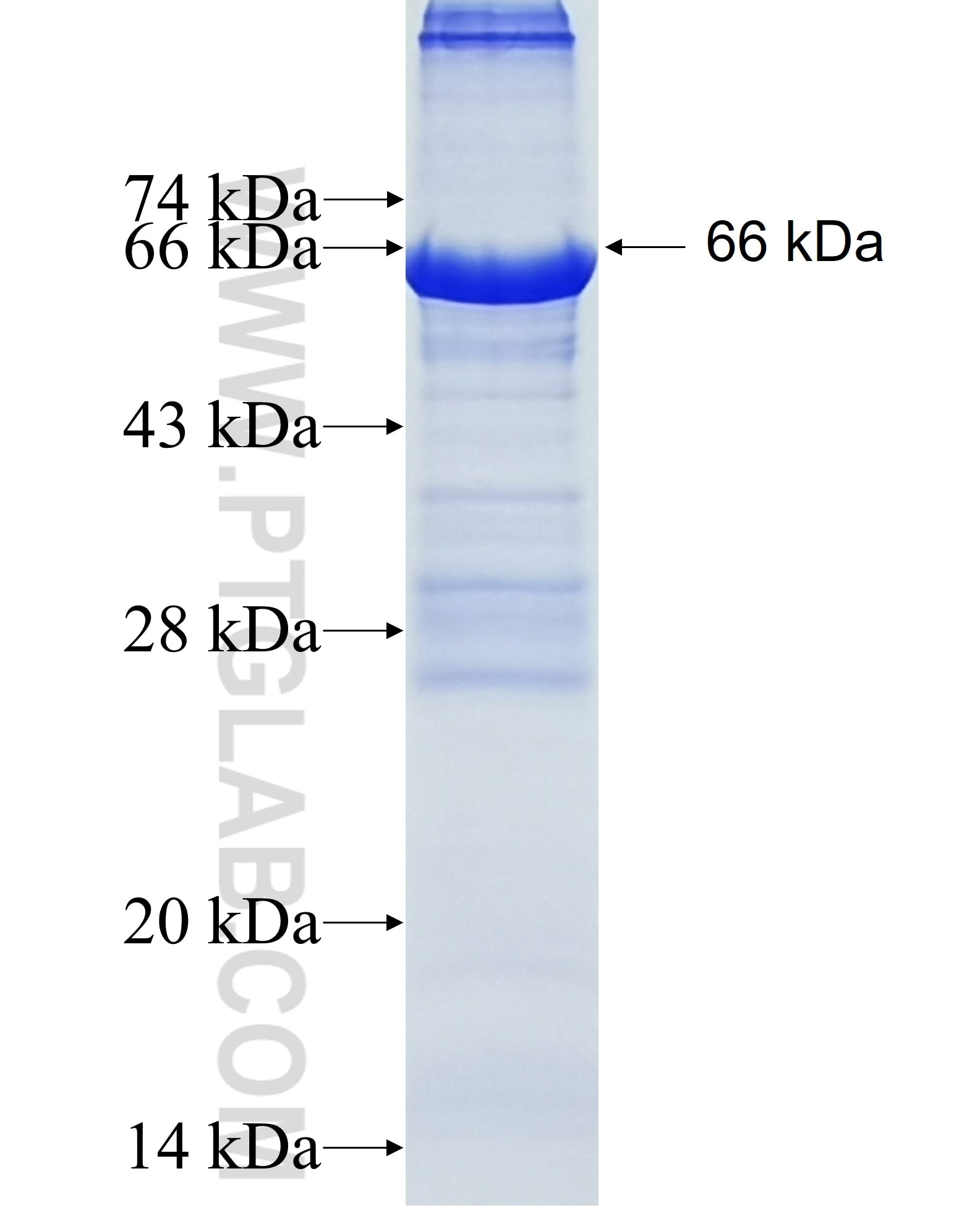 TSEN54 fusion protein Ag5561 SDS-PAGE