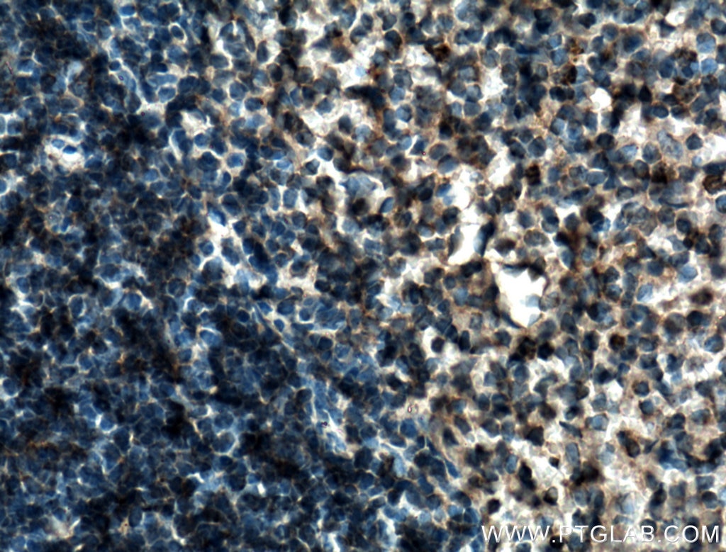 Immunohistochemistry (IHC) staining of mouse spleen tissue using TSEPA Polyclonal antibody (27415-1-AP)