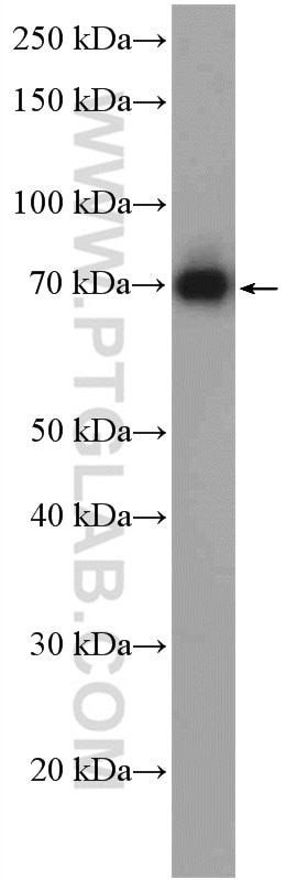 Western Blot (WB) analysis of Jurkat cells using TSEPA Polyclonal antibody (27415-1-AP)