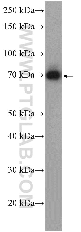 WB analysis of Jurkat using 27415-1-AP