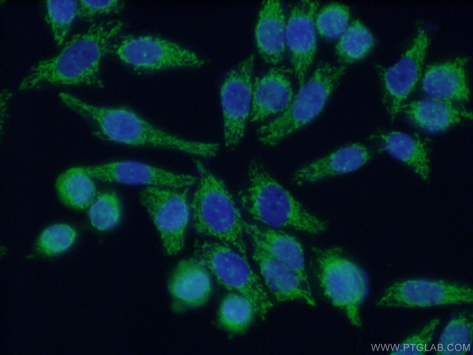 Immunofluorescence (IF) / fluorescent staining of HeLa cells using TSFM Polyclonal antibody (11701-1-AP)