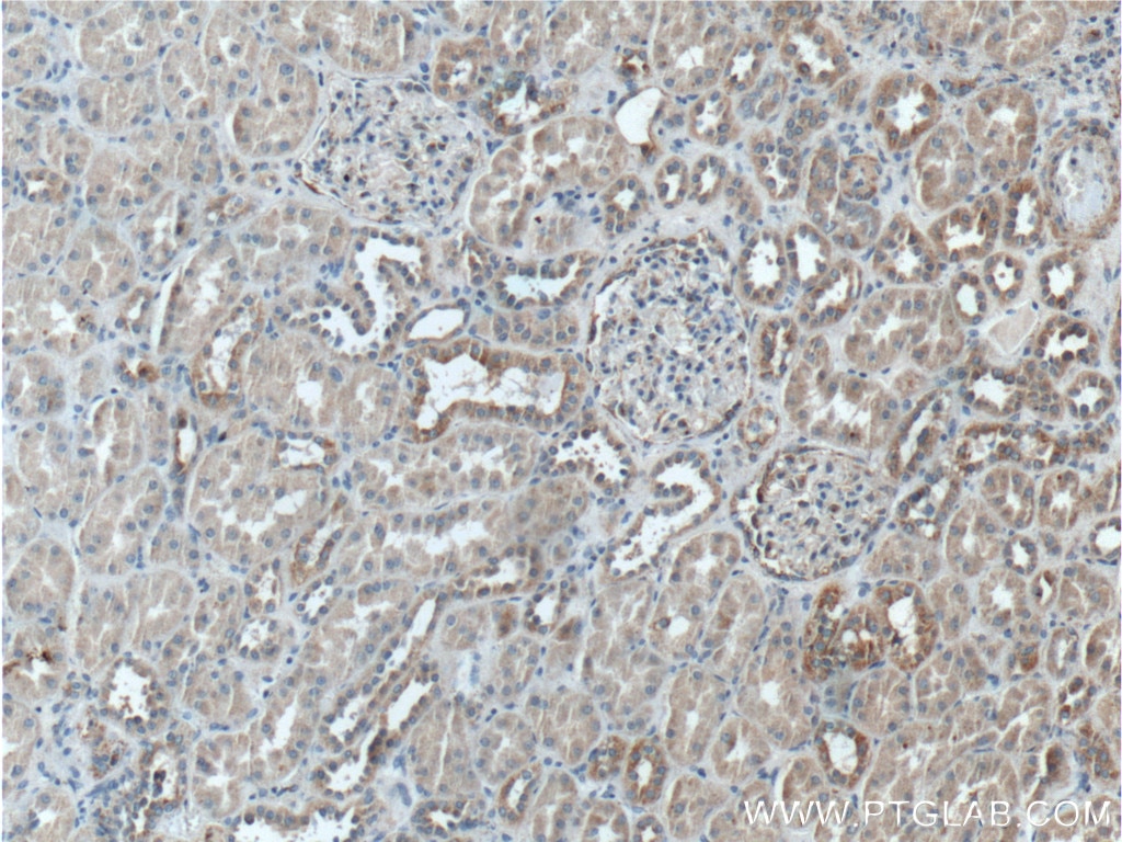 Immunohistochemistry (IHC) staining of human kidney tissue using TSFM Polyclonal antibody (11701-1-AP)