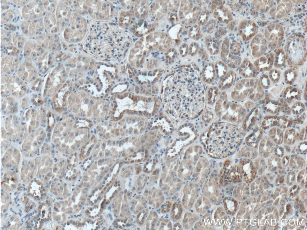 IHC staining of human kidney using 11701-1-AP