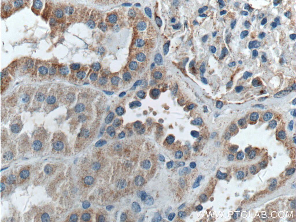 Immunohistochemistry (IHC) staining of human kidney tissue using TSFM Polyclonal antibody (11701-1-AP)