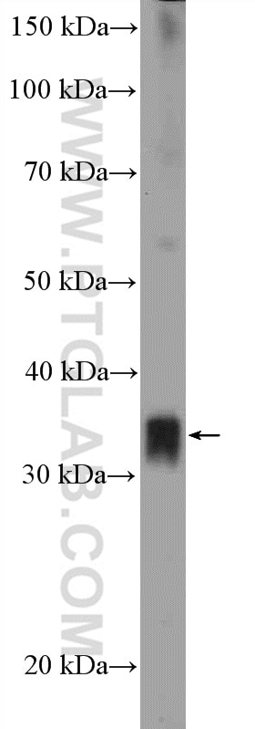 WB analysis of PC-3 using 11701-1-AP