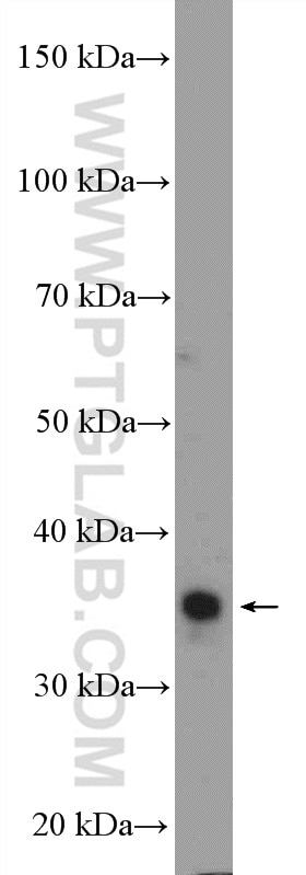 TSFM Polyclonal antibody