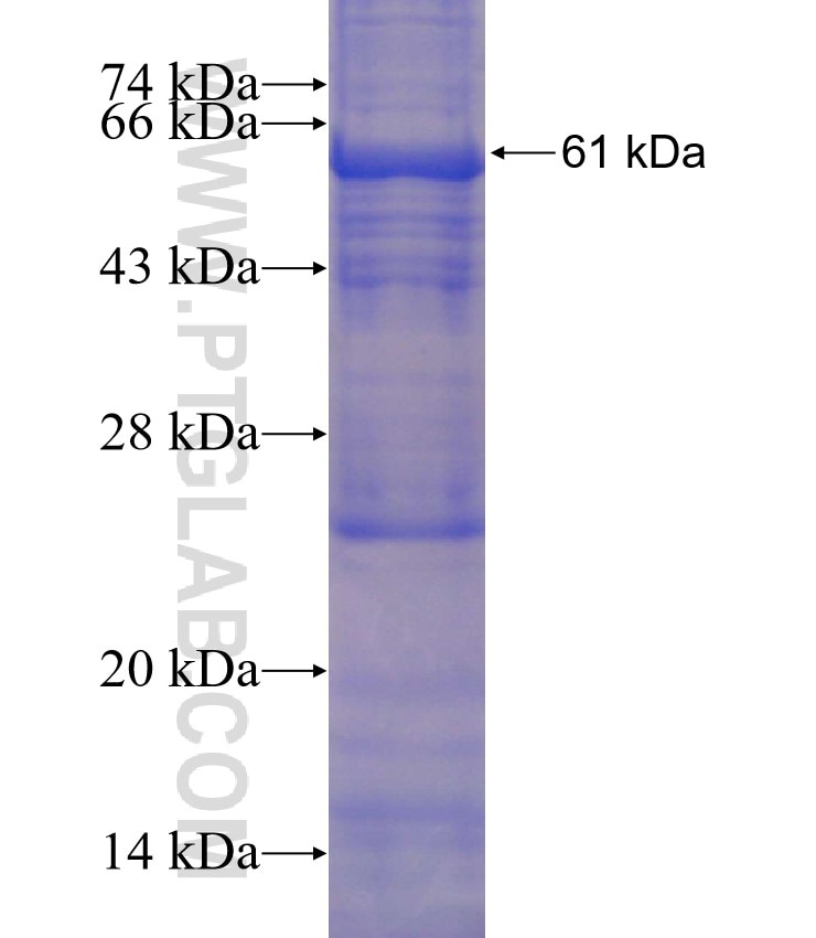 TSFM fusion protein Ag2308 SDS-PAGE