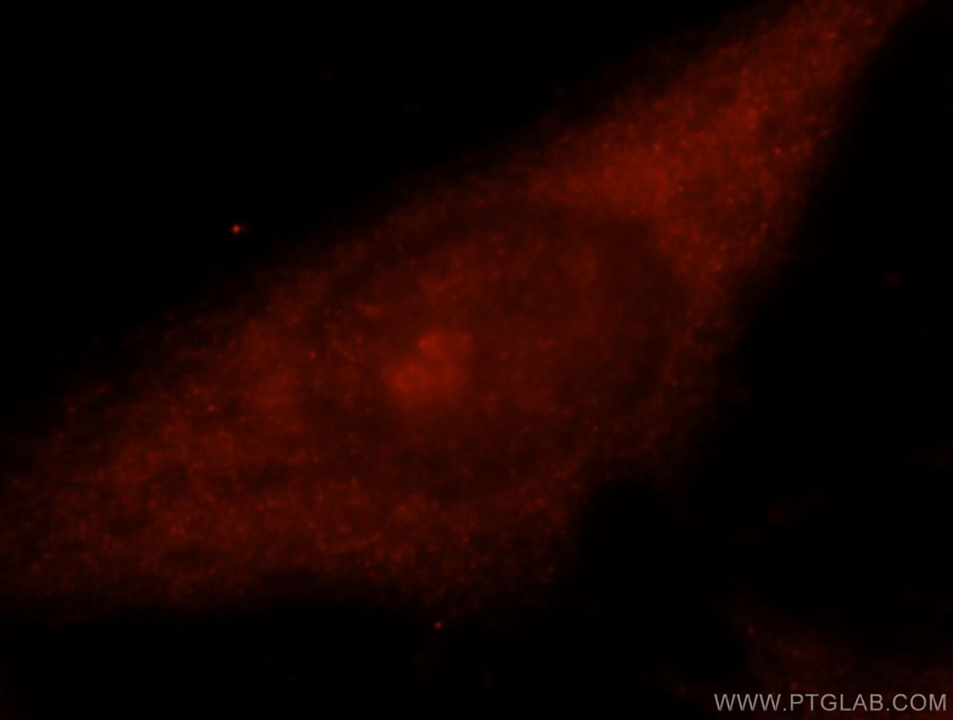 Immunofluorescence (IF) / fluorescent staining of HeLa cells using TSG101 Polyclonal antibody (14497-1-AP)