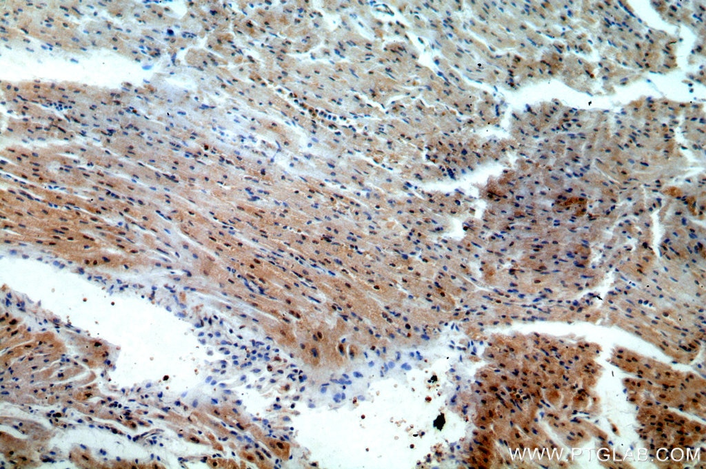 Immunohistochemistry (IHC) staining of human heart tissue using TSG101 Polyclonal antibody (14497-1-AP)