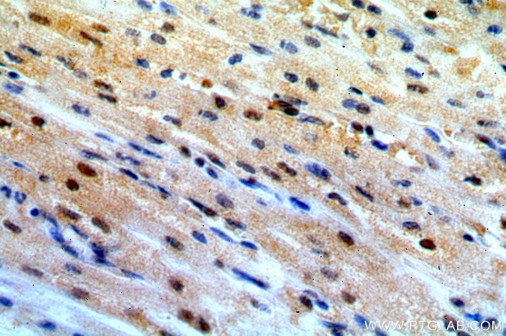 Immunohistochemistry (IHC) staining of human heart tissue using TSG101 Polyclonal antibody (14497-1-AP)