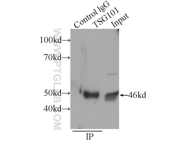 Immunoprecipitation (IP) experiment of HeLa cells using TSG101 Polyclonal antibody (14497-1-AP)