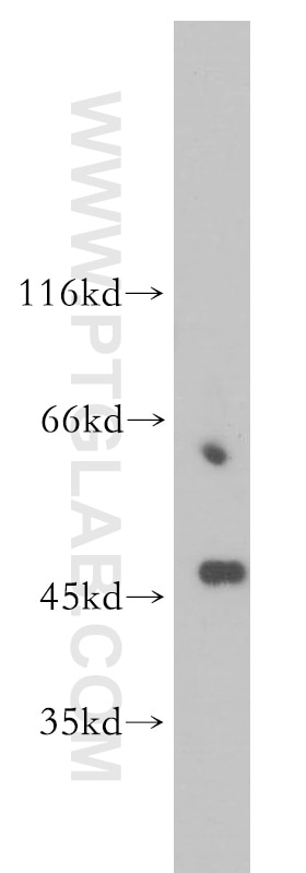 Western Blot (WB) analysis of NIH/3T3 cells using TSG101 Polyclonal antibody (14497-1-AP)