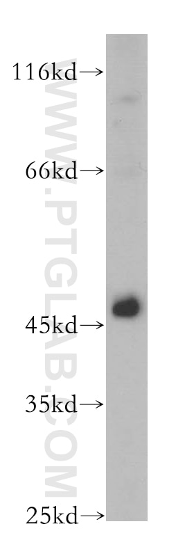 Western Blot (WB) analysis of HeLa cells using TSG101 Polyclonal antibody (14497-1-AP)