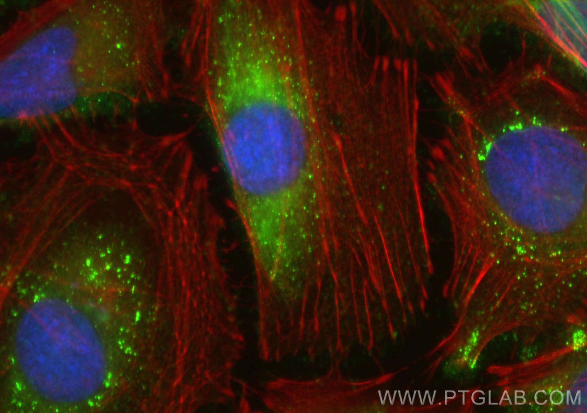 Immunofluorescence (IF) / fluorescent staining of HeLa cells using TSG101 Polyclonal antibody (28283-1-AP)