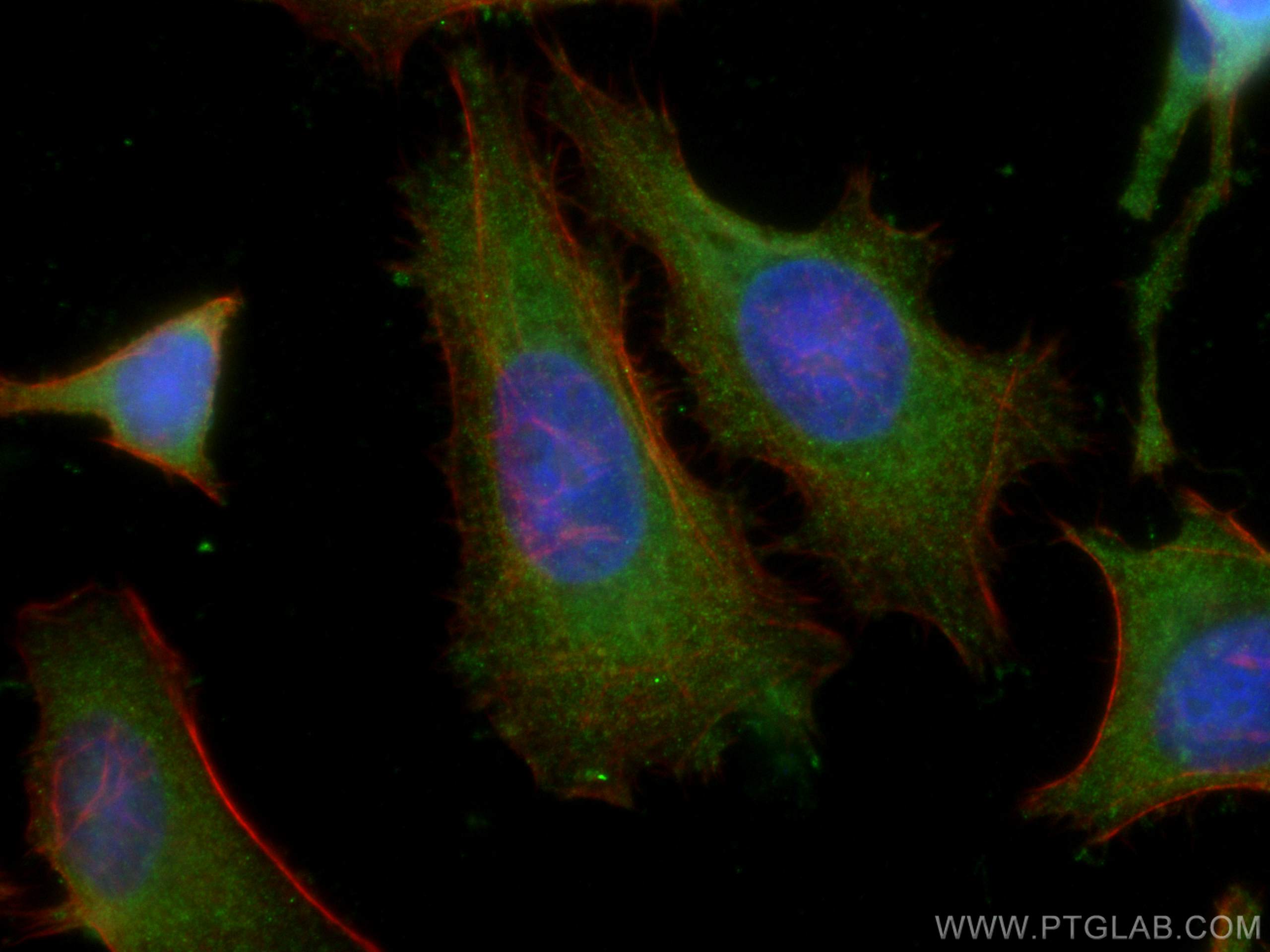 Immunofluorescence (IF) / fluorescent staining of HeLa cells using TSG101 Monoclonal antibody (67381-1-Ig)