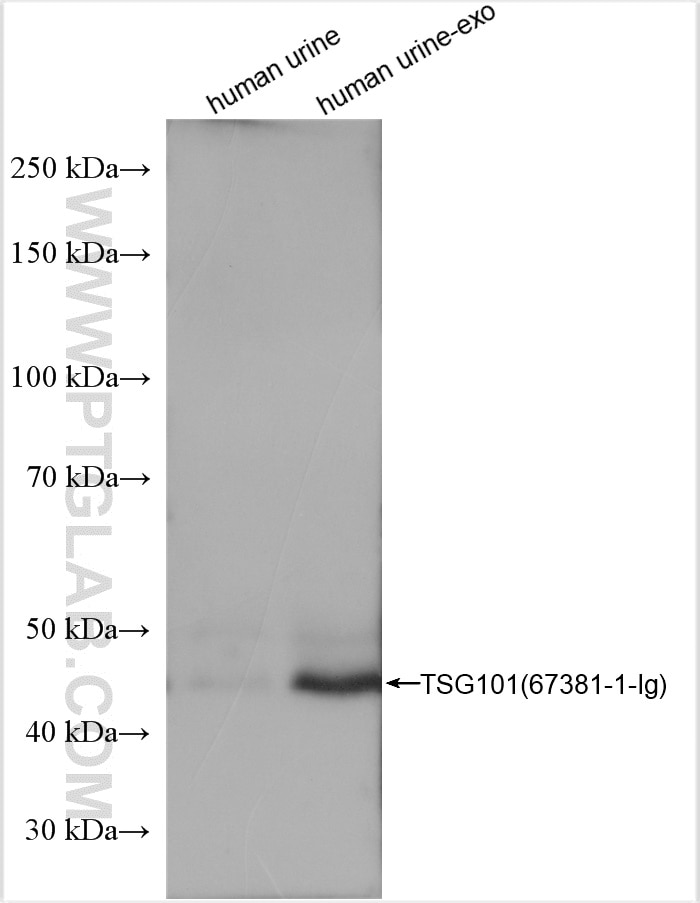 Western Blot (WB) analysis of human urine exosomes tissue using TSG101 Monoclonal antibody (67381-1-Ig)