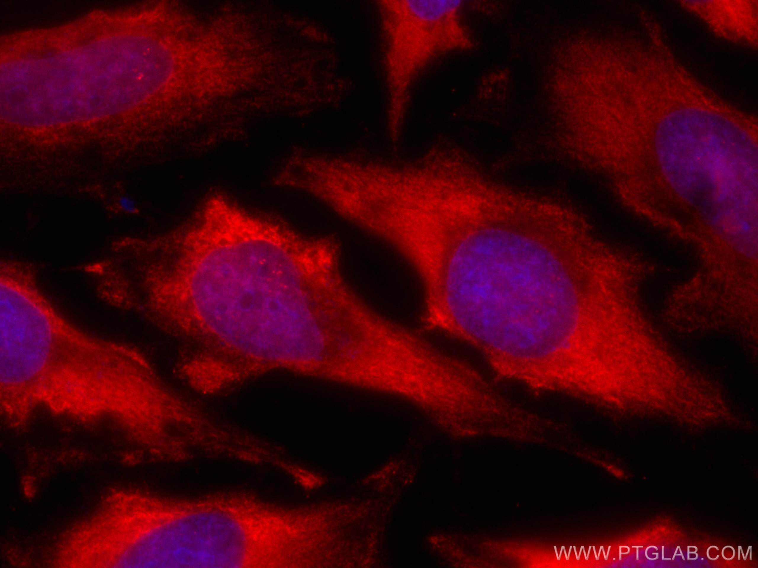 Immunofluorescence (IF) / fluorescent staining of HeLa cells using CoraLite®594-conjugated TSG101 Monoclonal antibody (CL594-67381)