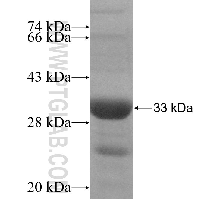 TSG101 fusion protein Ag5920 SDS-PAGE